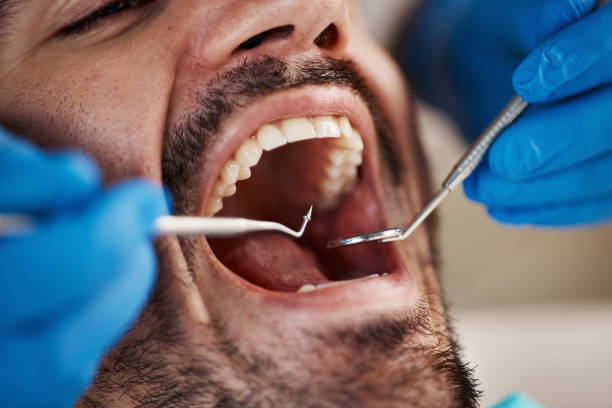 Best Emergency Treatment for Dental Infections or Abscesses in Rockford, MI