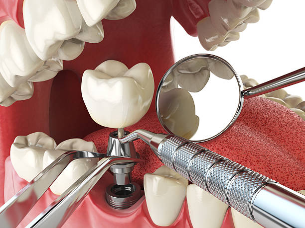 Best Emergency Gum Treatment in Rockford, MI