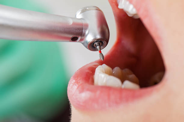 Best Same-Day Emergency Dental Services in Rockford, MI
